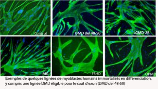Exemples de quelques lignées de myoblastes humains immortalisés en différenciation, y compris une lignée DMD éligible pour le saut d'exon (DMD del 48-50)