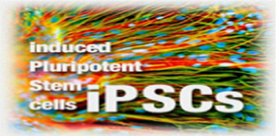 CRM-iPSC-19jan16