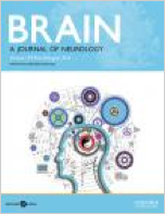 Brain Aug16