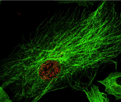 marquage-par-immunofluorescence-du-vecteur-aav-dans-des-cellules-musculaires-issues-de-biopsies-humaines
