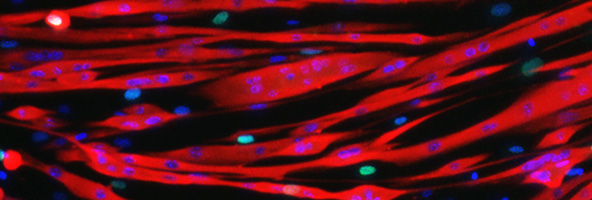 Myotubes multinucléés en culture in vitro (bleu: noyaux, rouge: chaînes lourdes de myosite)