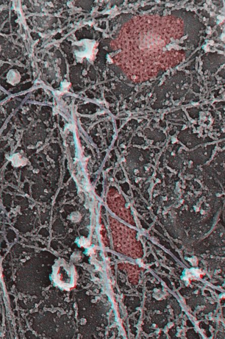 Clathrin is pseudo-coloured in red and the intermediate filaments are purple.