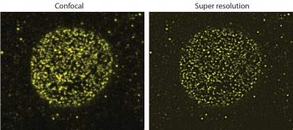 Comparaison entre deux prises de vue, une en mode confocal, l’autre en mode super résolution, du même noyau marqué pour les pores nucléaires, où on distingue très bien le gain de résolution obtenu.