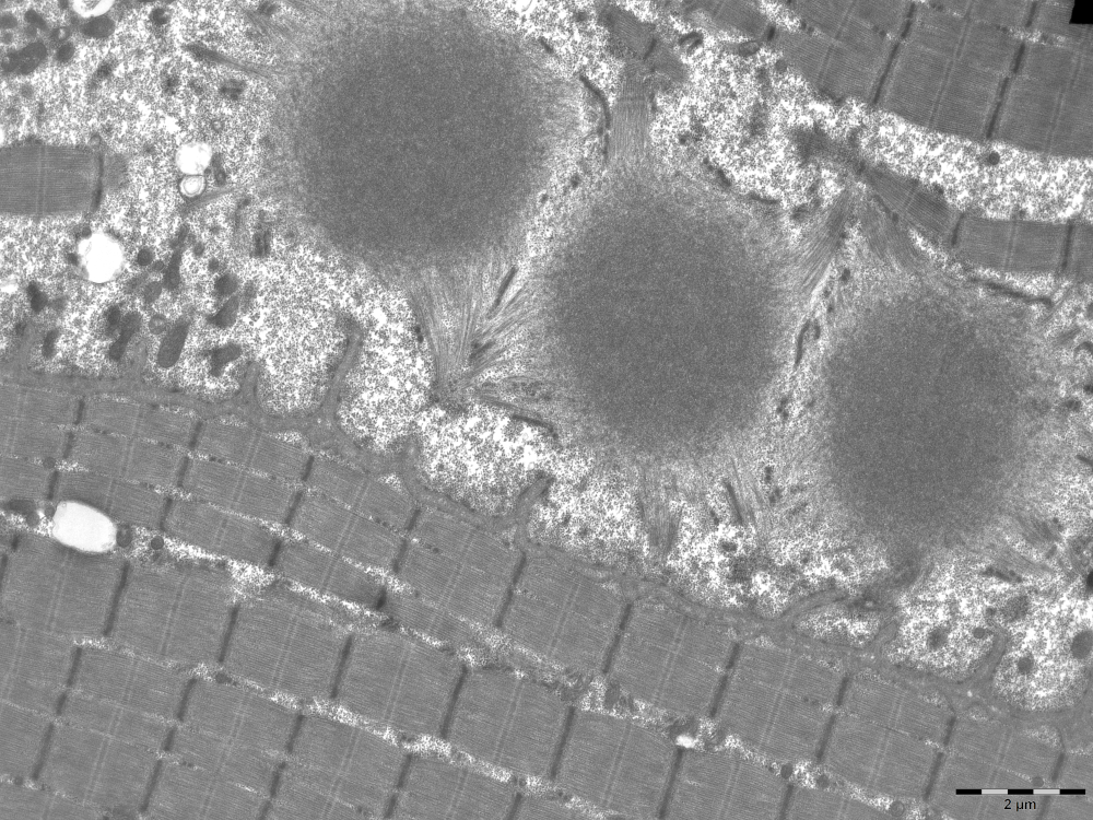 Microscope électronique à transmission - Neurophotonics Centre